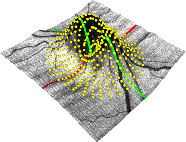 Retinal layers